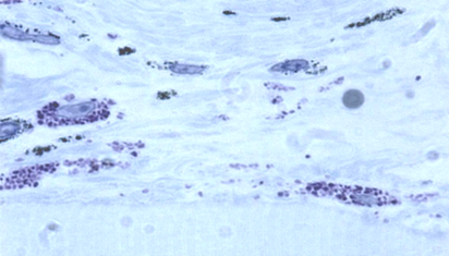 Abbildung 4: Mastzellen (dunkelblau) – die Zellen, die urtikarielle Beschwerden auslösen. (Quelle: Allergie Centrum Charité)